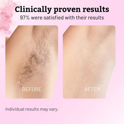 Cyperus Permanent Hair Removing Oil